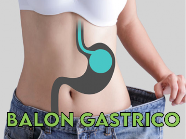 balon gastrico en lima